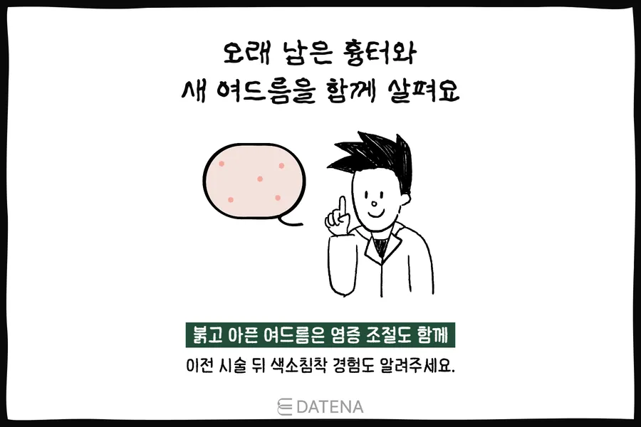 赤いニキビと長く残った傷あとをあわせて診る医師のイラスト