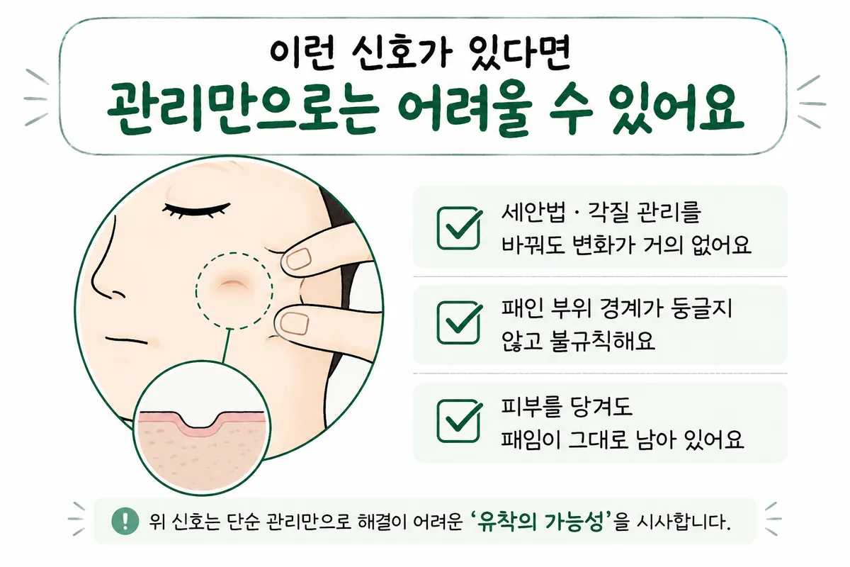 洗顔や角質ケアの後も残るへこみ、不規則な境界、肌を引っ張っても残る凹凸のチェックイラスト