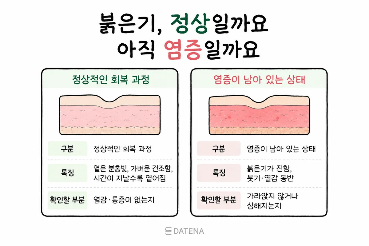薄れていく赤みと、腫れ・熱感を伴う赤みを比較した肌状態の図